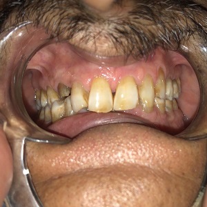 best dental clinic Patna Bihar