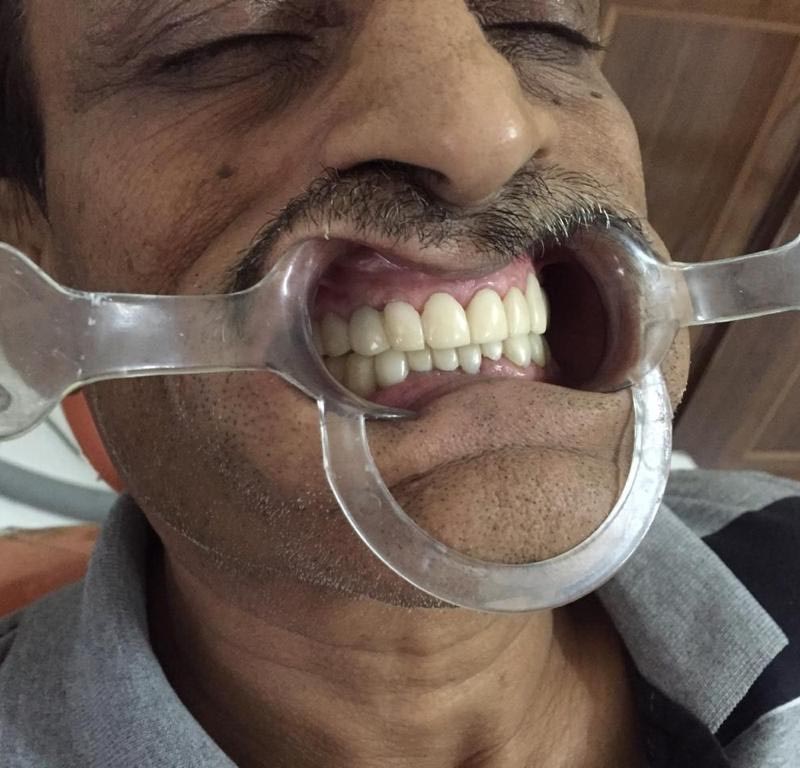 dental clinic in Patna