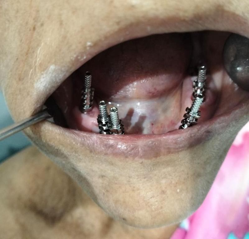 Dental clinic in Kankarbagh Patna