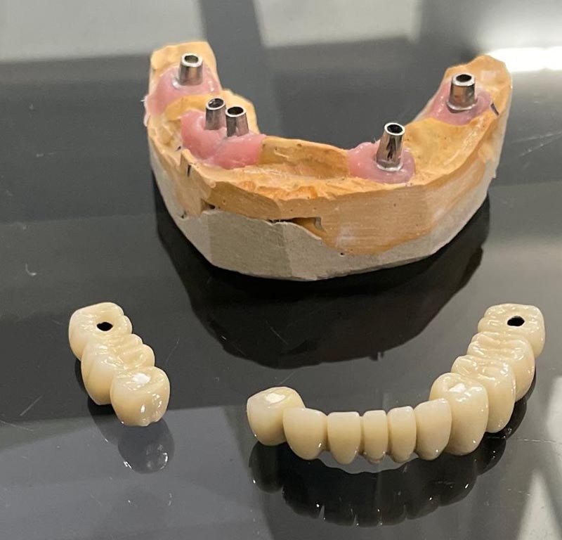 Best Dental clinic in Kankarbagh Patna