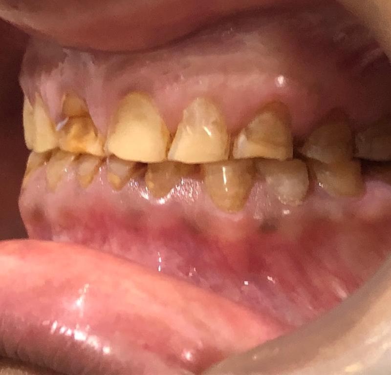 Infection and Hygiene Control Dental Clinic Patna