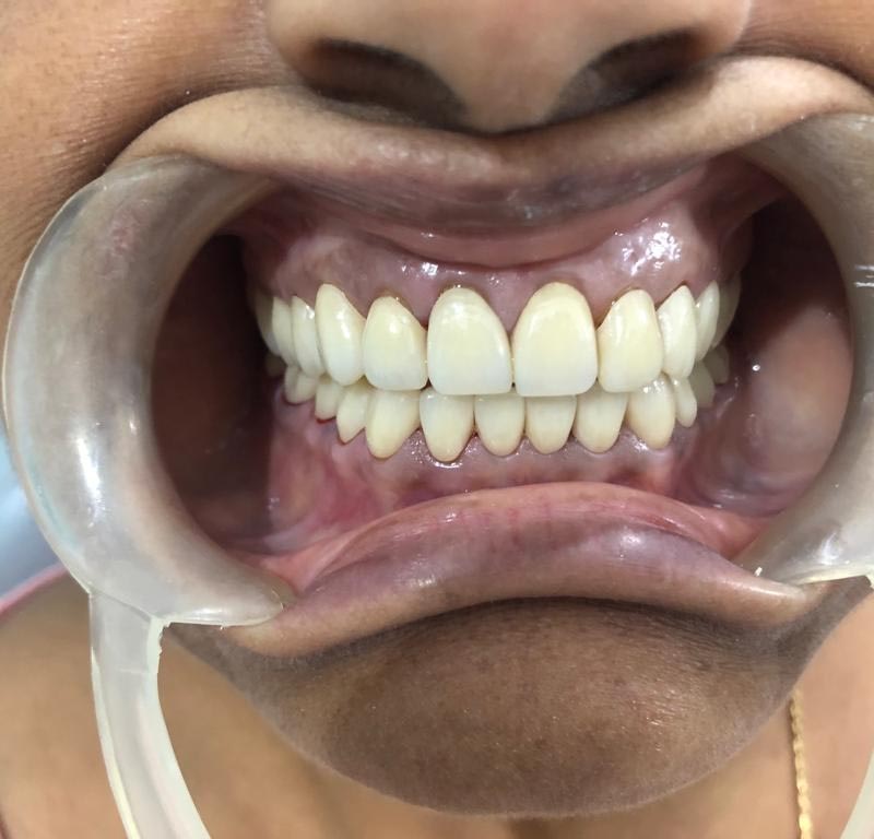 Chiild Dentistry in Patna