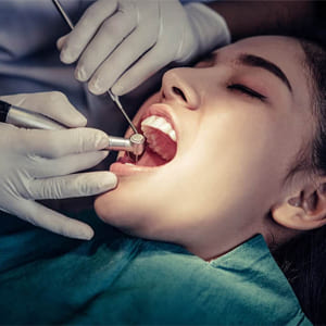 Best dental clinic for root canal treatment in Patna